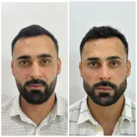 فقط فردا ۹۸۰ /کانتورینگ/فیلر/تعدادمحدود|خدمات آرایشگری و زیبایی|رشت, کوی حسینی|دیوار