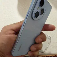 honor 400 pro نسخه چین|موبایل|شهر ری, شهادت|دیوار