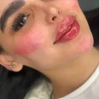 خدمات ژل و بوتاکس