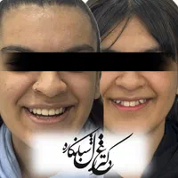 ارتودنسی با شرایط اقساط و منعطف|خدمات آرایشگری و زیبایی|تهران, دزاشیب|دیوار