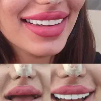 دندان مصنوعی پروتز متحرک