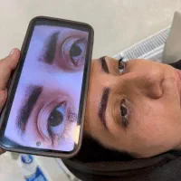 پاک تتوریموو تتو در کیلینیک بدون درد /ریمو ابرو