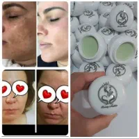 کرم ملکه زیبایی ضد لک قوی