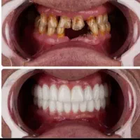 مرکز تخصصی دندان پزشکی و ایمپلنت مختص افراد حساس|خدمات زیبایی و سلامت|تبریز, |دیوار
