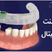 مرکزفوق تخصصی ایمپلنت دیجیتال/ایمپلنت فوری/بی درد|خدمات آرایشگری و زیبایی|مشهد, کوه سنگی|دیوار