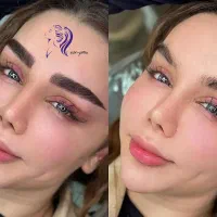 آموزش فیبروز و میکرو تخصصی