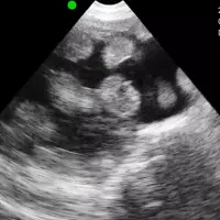 سونوگرافی انواع دام