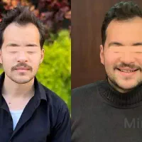 //معجزه زیبایی صورت و بدن//