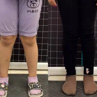 مربی حرکات اصلاحی  زانو پرانتزی و ضربدری، بدنسازی