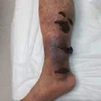 حجامت ،فصدوزالو،سم زدا ویونیزاسیون ماساژ درمانی