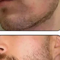 نوشیدنی رویش