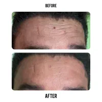 انجام کلیه خدمات زیبایی توسط پزشک در کلینیک در فسا|خدمات آرایشگری و زیبایی|فسا, |دیوار
