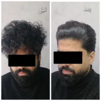 کراتینه،بوتاکس، پروتئینه، پاکسازی و رنگ مو