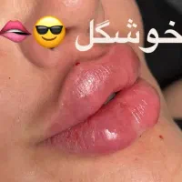 ژل و بوتاکس|خدمات آرایشگری و زیبایی|شیراز, شهرک مهدی‌آباد|دیوار