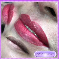 میکروبلیدینگ فیبروز شیدلب بنمژه ریموو|خدمات آرایشگری و زیبایی|شیراز, کوی زهرا|دیوار