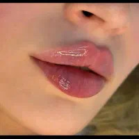 آموزش و تخفیفات ژل و بوتاکس