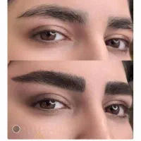 فیبروز ابرو