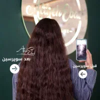 درمان ریزش مو رشد مجدد تک جلسه گارا نتی دار