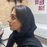 جشنواره زیبایی عمل بینی رینوپلاستی سیما سرچشمه