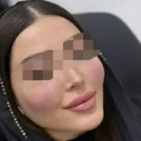 جشنواره تزریق ژل و بوتاکس 450|خدمات زیبایی و سلامت|تهران, نازی‌آباد|دیوار