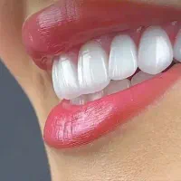 خدمات دندانپزشکی دکتر کریمی دزفول