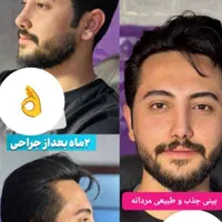 عمل جراحی بینی، ترمیمی،  لیفت صورت،  لیپو ابدو|خدمات آرایشگری و زیبایی|تهران, نارمک|دیوار