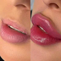 اموزش ژل و بوتاکس در نوبهار اکادمی سهرابی|خدمات آموزشی|کرمانشاه, |دیوار