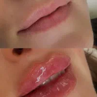 تخفیف فوق العاده خدمات ژل و بوتاکس در مطب|خدمات آرایشگری و زیبایی|شاهینشهر, بوستان حافظ|دیوار