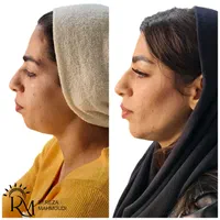 بلک فرایدی زیبایی کلینیک دکتر محمودی|خدمات آرایشگری و زیبایی|کرمان, |دیوار