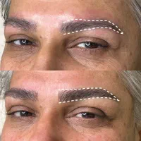 میکروبلیدینگ|خدمات زیبایی و سلامت|رشت, پاستوریزه|دیوار