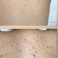 فیشال تخصصی صورت وایتنینگ بدن در کلینیک زیرنظرپزشک|خدمات آرایشگری و زیبایی|اسلامشهر, باغ فیض|دیوار