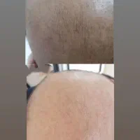 محصولات تخصصی مراقبت از مو