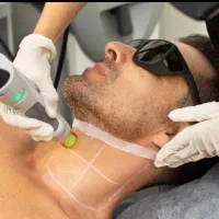 مرکز تخصصی لیزر آقایان توسط اپراتور آقا حرفه ای