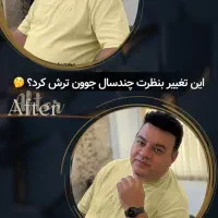 پروتز و ترمیم موی افشان|خدمات آرایشگری و زیبایی|مشهد, کوثر|دیوار