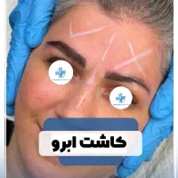 جشنواره کاشت ابرو دکتر خراسانی