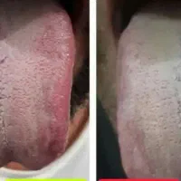 سونوگرافی آنلاین ورایگان