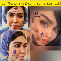 جشنواره عیدانه پلک.شقیقه.ابرو.سانترال لب.