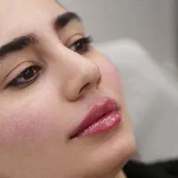 ژل لب بوتاکس فیلر انزیم ساکشن غبغب گونه زاویه سازی|خدمات آرایشگری و زیبایی|مشهد, سجاد شهر|دیوار