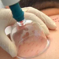 حجامت در منزل و محل کار شما