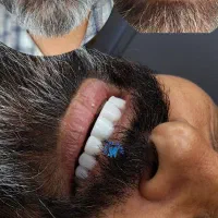 کامپوزیت دندان با تخفیف ویژه وهر8 واحد1واحد رایگان