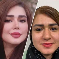 جراحی و عمل بینی با دستگاه پیزو فقط ۲۲/ترمیم بینی