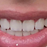 دستیار خانم دندانپزشکی حرفه ای