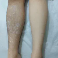 مرکز اپیلاسیون تخصصی بانوان در قاسم آباد|خدمات آرایشگری و زیبایی|مشهد, شهرک رازی (شهرک غرب)|دیوار