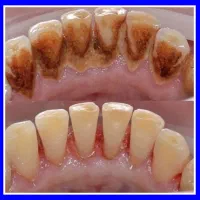 دندانپزشکی/کامپوزیت/ایمپلنت/عصبکشی/ترمیم جرمگیری