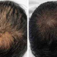 حجم دهی طی بازه زمانی کوتاه