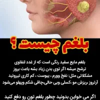 درمان بلغم