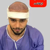 کاشت مووابرو با تخفیف درکلینیک تخصصی تبریز|خدمات آرایشگری و زیبایی|اردبیل, |دیوار