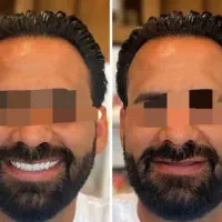 دندان سازی، دندان مصنوعی ،تعمیر دندان مصنوعی