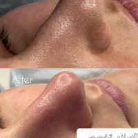 پاکسازی تخصصی تخفیف تا یک هفته|خدمات آرایشگری و زیبایی|گتوند, |دیوار