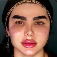 سفید کننده لک پیس درمانی